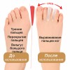 ORTONOG.KZ ортопедический разделитель пальцев стопы