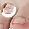 Силиконовые корректирующие подушечки для лечения вросших ногтей.