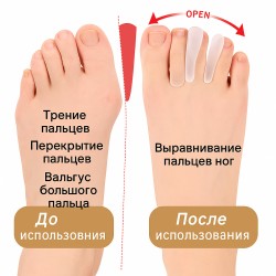 ORTONOG.KZ ортопедический разделитель пальцев стопы